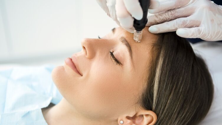 anti-aging-all-you-need-to-know-about-microneedling-technique