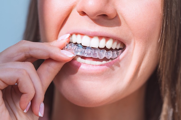 Woman,With,Perfect,Smile,Wearing,Invisible,Dental,Aligners,For,Dental