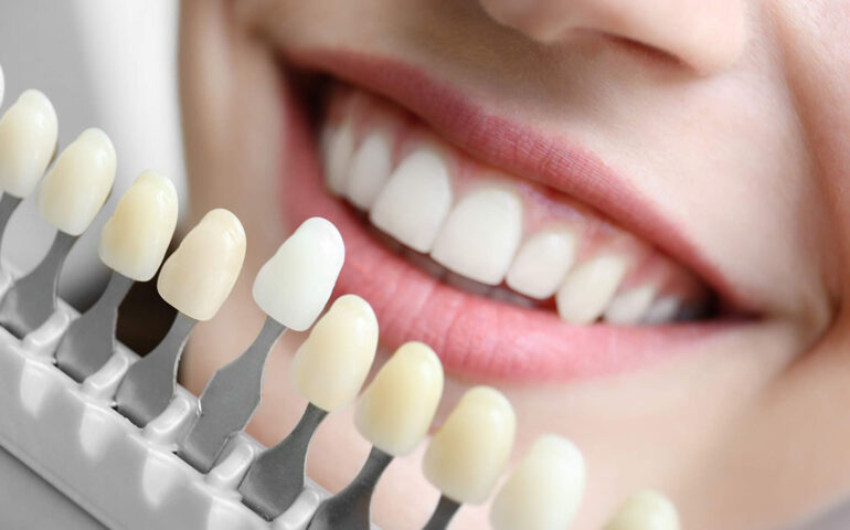 Cosmetic Dentistry Ahmedabad