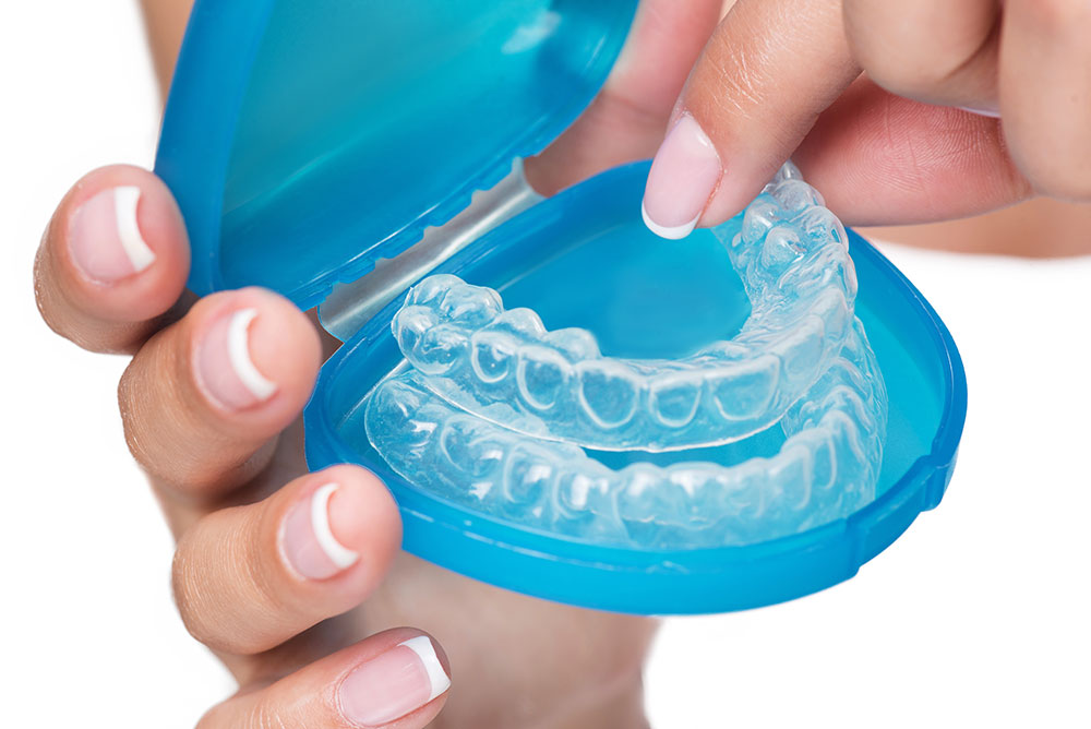 3-ways-to-keep-your-invisalign-aligners-clean