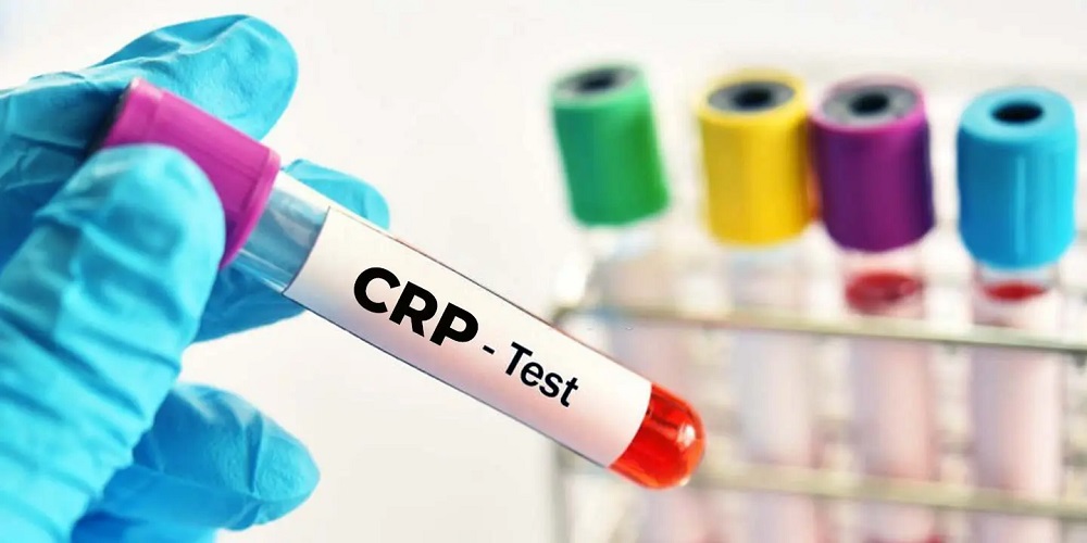 CRP Test